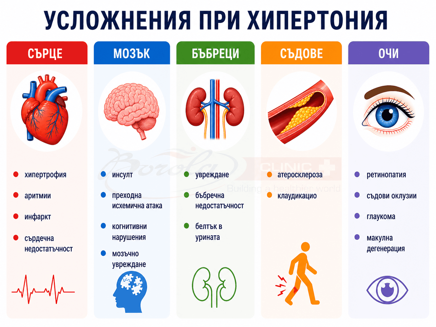 Усложнения при хипертония – сърдечни, мозъчни, бъбречни, съдови и очни Инфографика за усложнения при хипертония, показваща увреждания на сърце, мозък, бъбреци, кръвоносни съдове и очи, включително инфаркт, инсулт, бъбречна недостатъчност, атеросклероза и ретинопатия